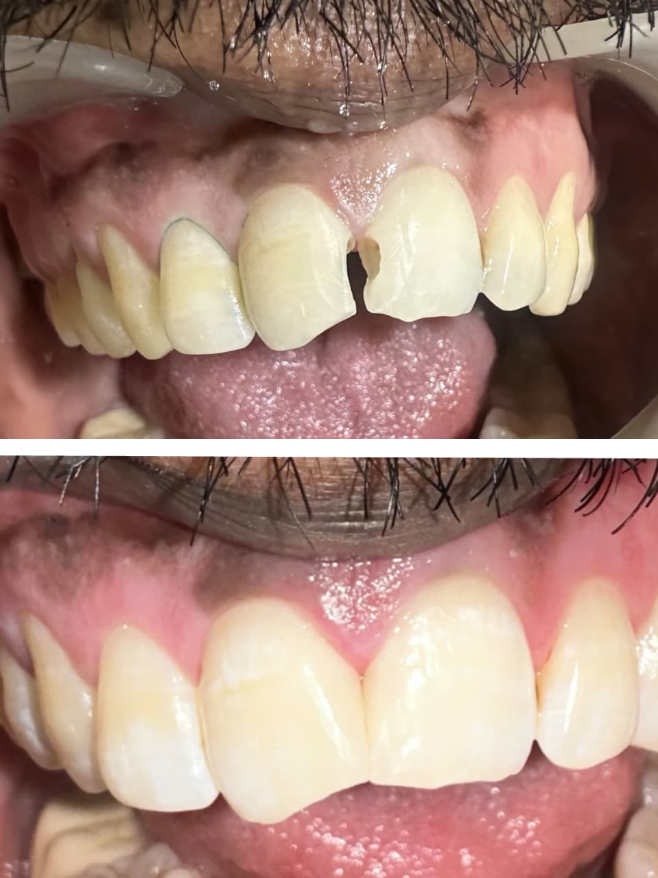 Orthodontic Correction